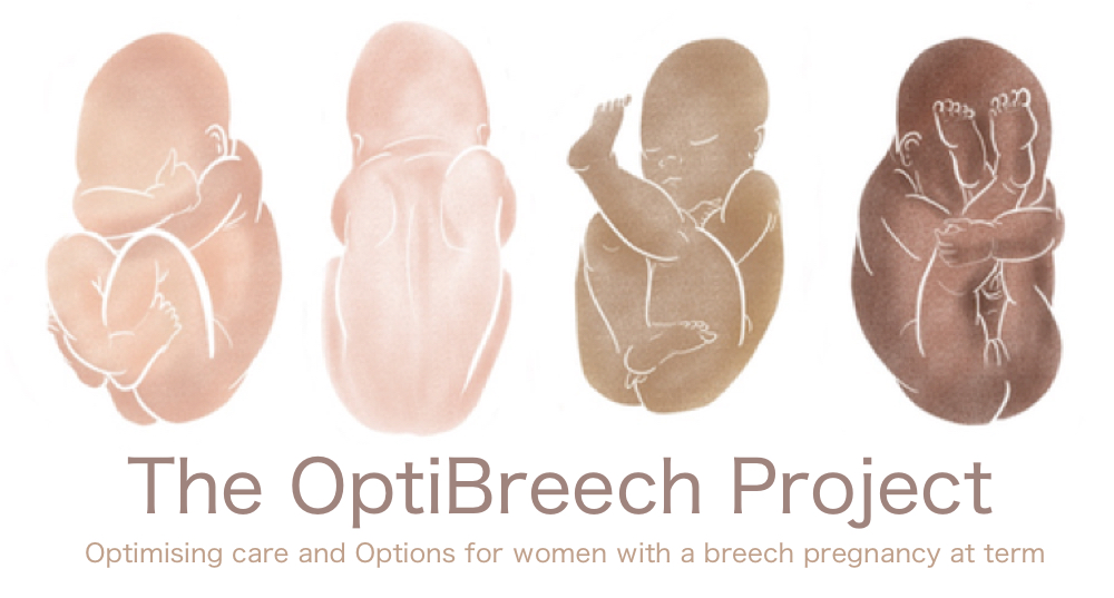The OptiBreech Project: Optimising care and Options for women with a breech pregnancy at term